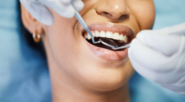 Best Urgent Care for Lost Fillings or Crowns in Middlebush, NJ